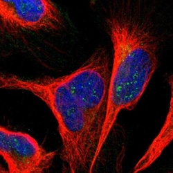 ANKS6 Antibody, Novus Biologicals 25 &mu;L | Buy Online | Novus Biologicals | Fisher Scientific